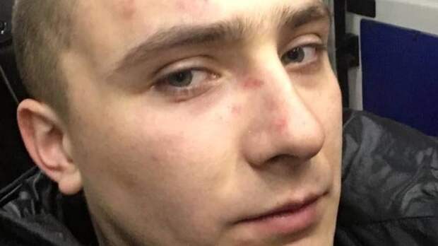В Одессе избили экс-лидера местного «Правого сектора» Сергея Стерненко